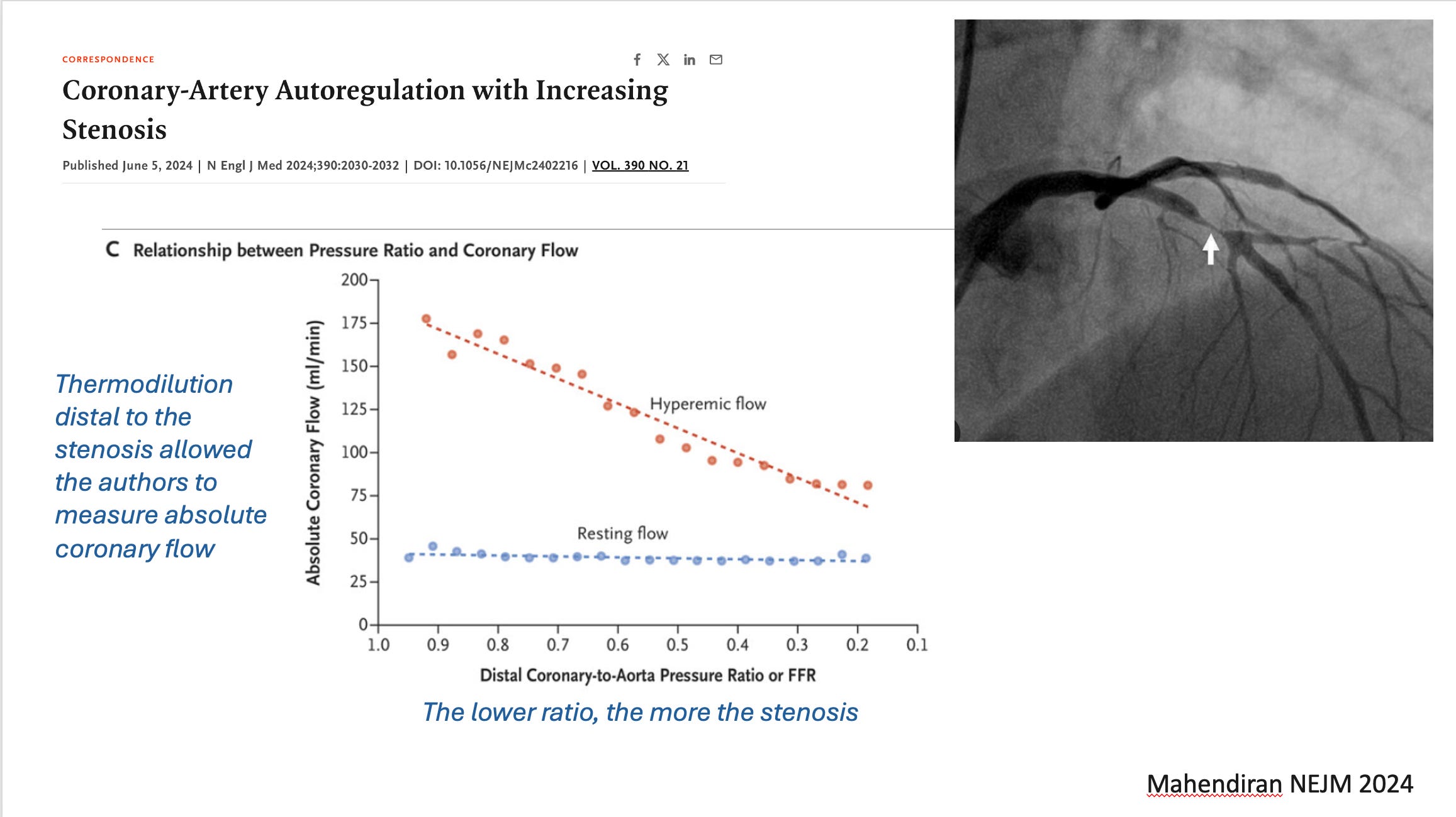 A Discussion with Professor Venk Murthy on Coronary Artery Disease