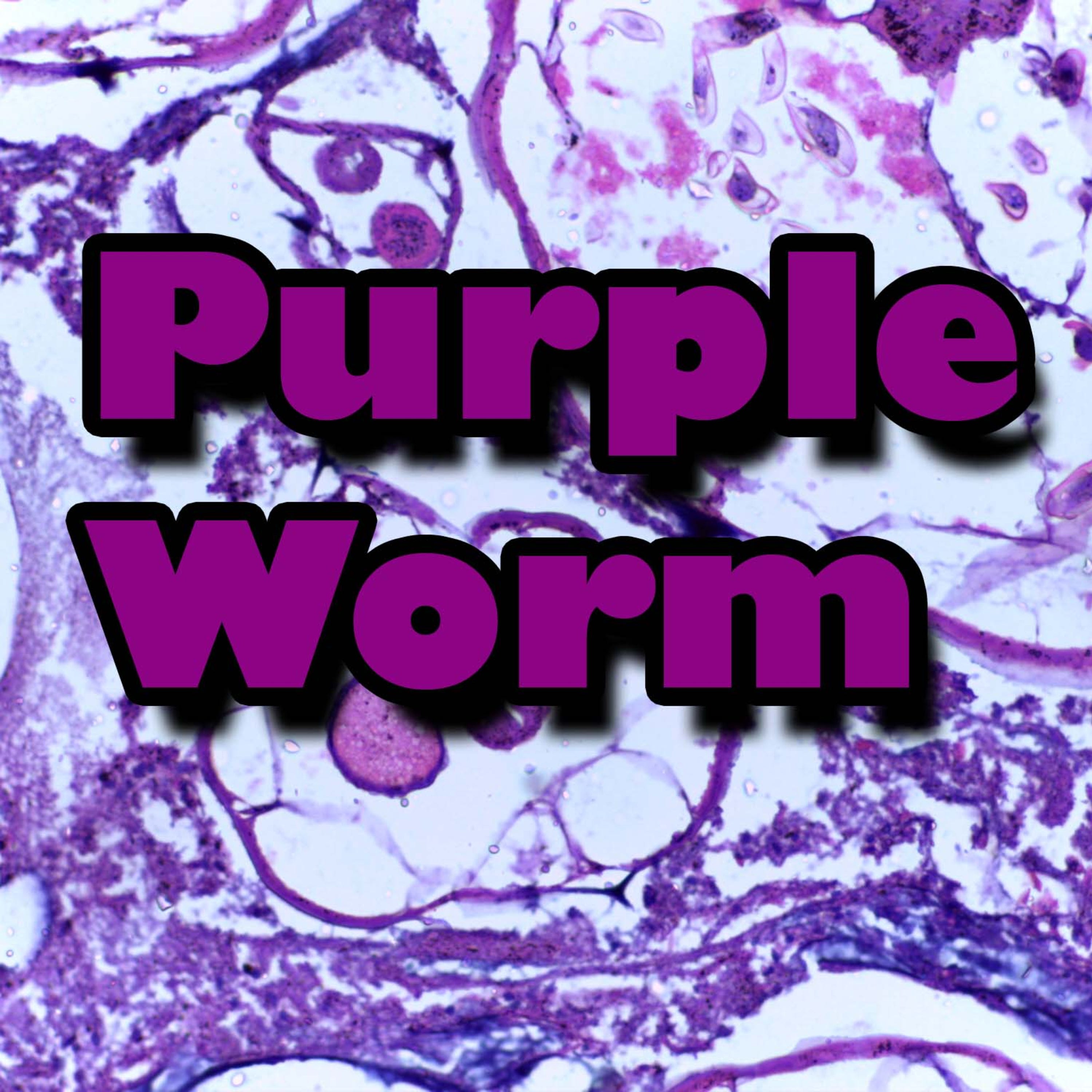 Wormsign! The first episode of the Purple Worm draws near