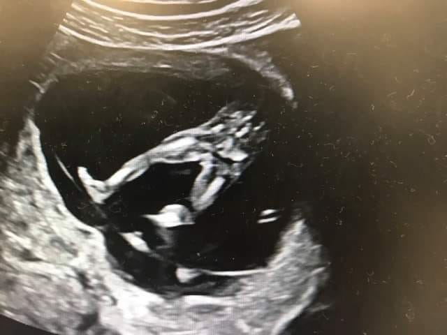 You knitted me together