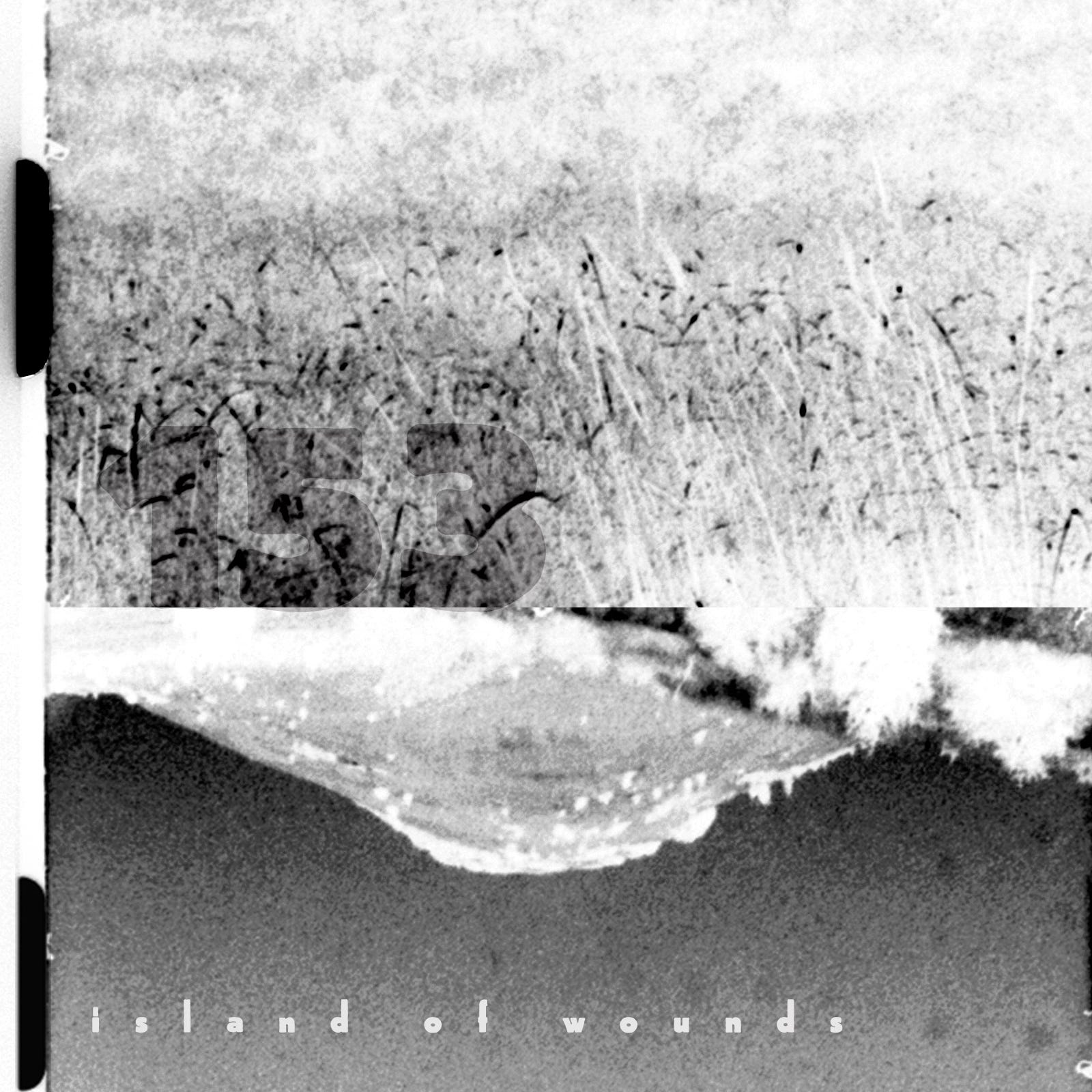 island of wounds episode artwork