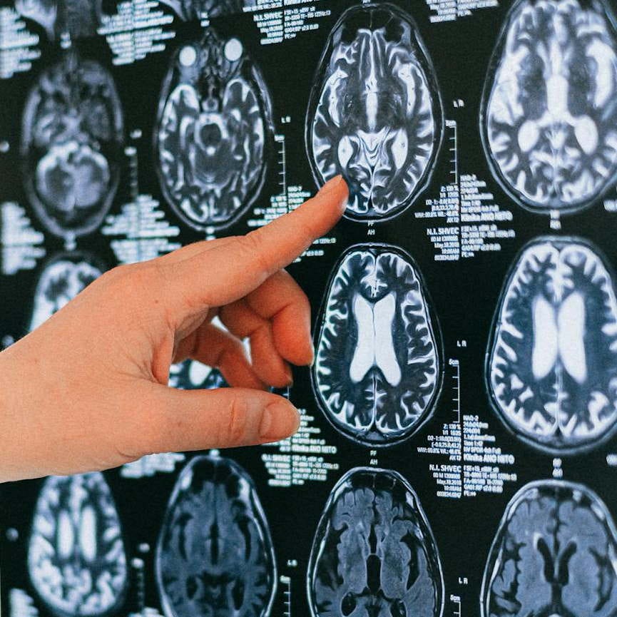 Stream of Subconsciousness