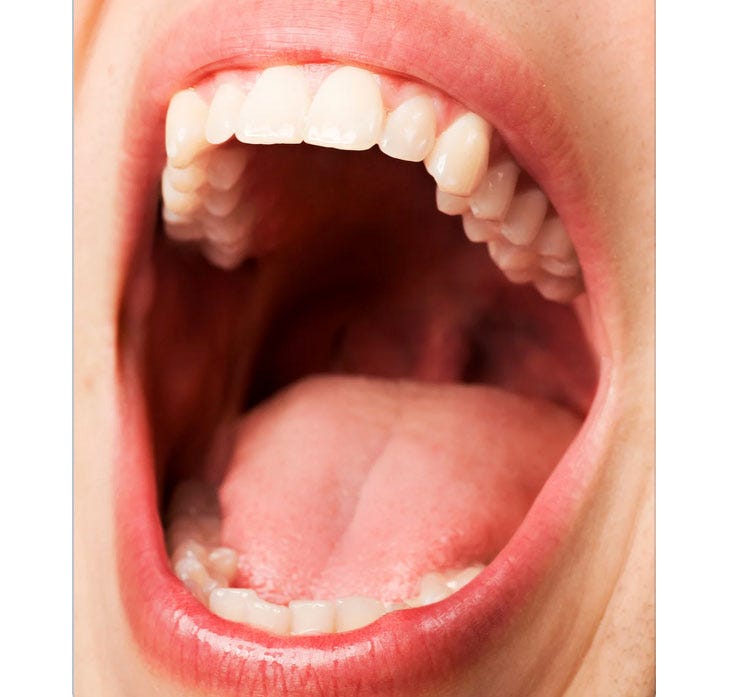 IBS Deep Dive! Why buccal is your word of the day episode artwork