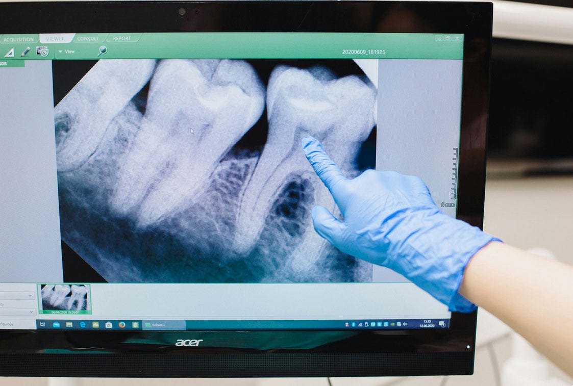 Heather\'s IBS Newsletter - Help for Irritable Bowel Syndrome.