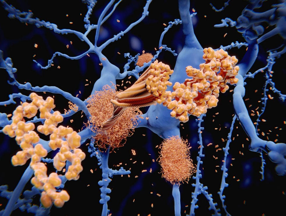 Audio. IBS news flash. Gut hormone peptide levels lower in people with IBS episode artwork