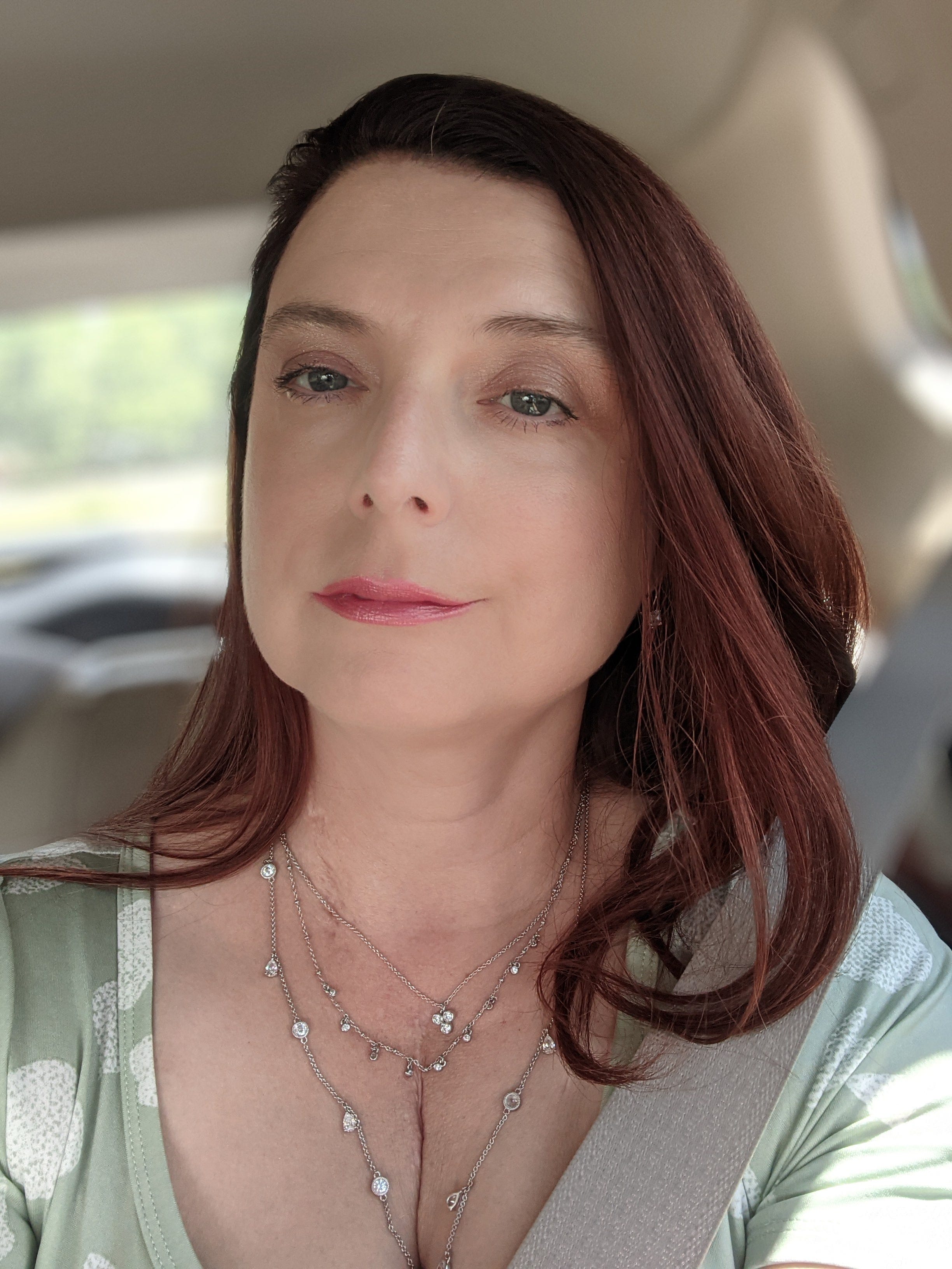 Guest Post: Dawn Levitt, Two-Time Heart Transplant Recipient episode artwork