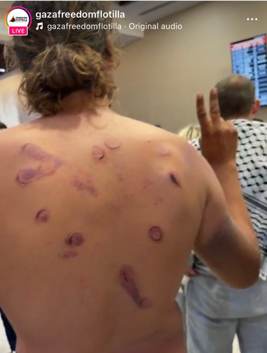 Flotilla Participants Tortured In Israel, Treated Harshly in Spain, Sanctioned by US episode artwork