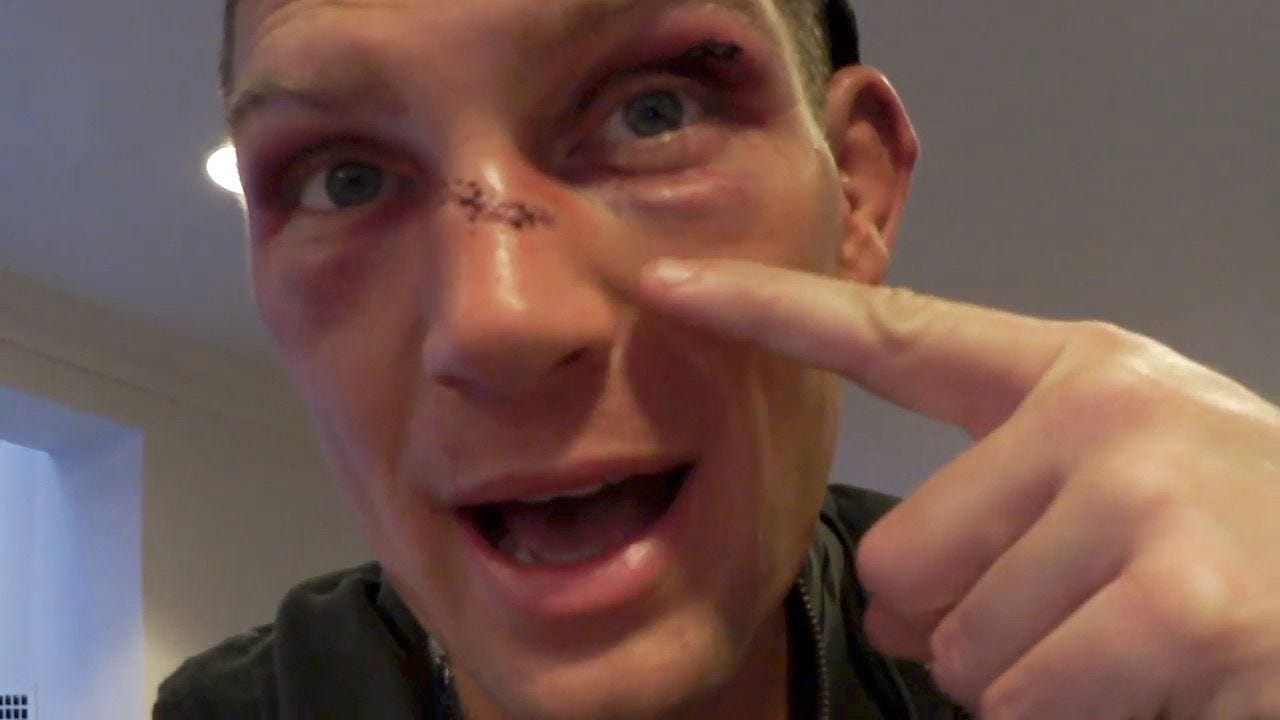 The Brit Pack MMA Podcast