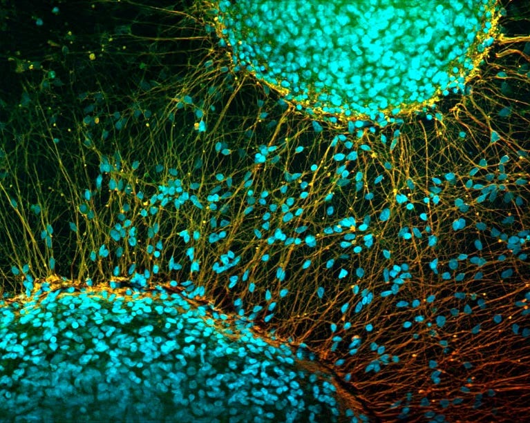 🦠 Stem Cells | 🧠 Brain Savers | 💉 Cancer Crusaders | 🤖 AI Allies | 🌱 Cannabis