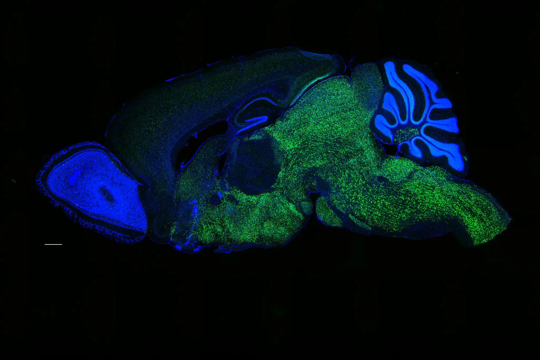 The Gene That May Have Helped Shape Human Language episode artwork