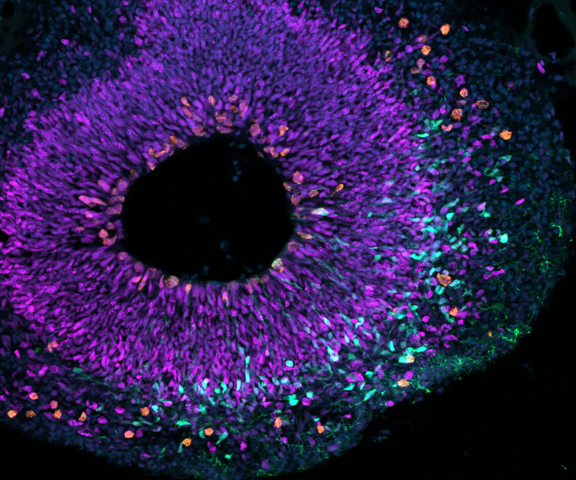 The Evolutionary Roots of the Human Brain: How Two Genes Shaped Our Cognitive Landscape episode artwork