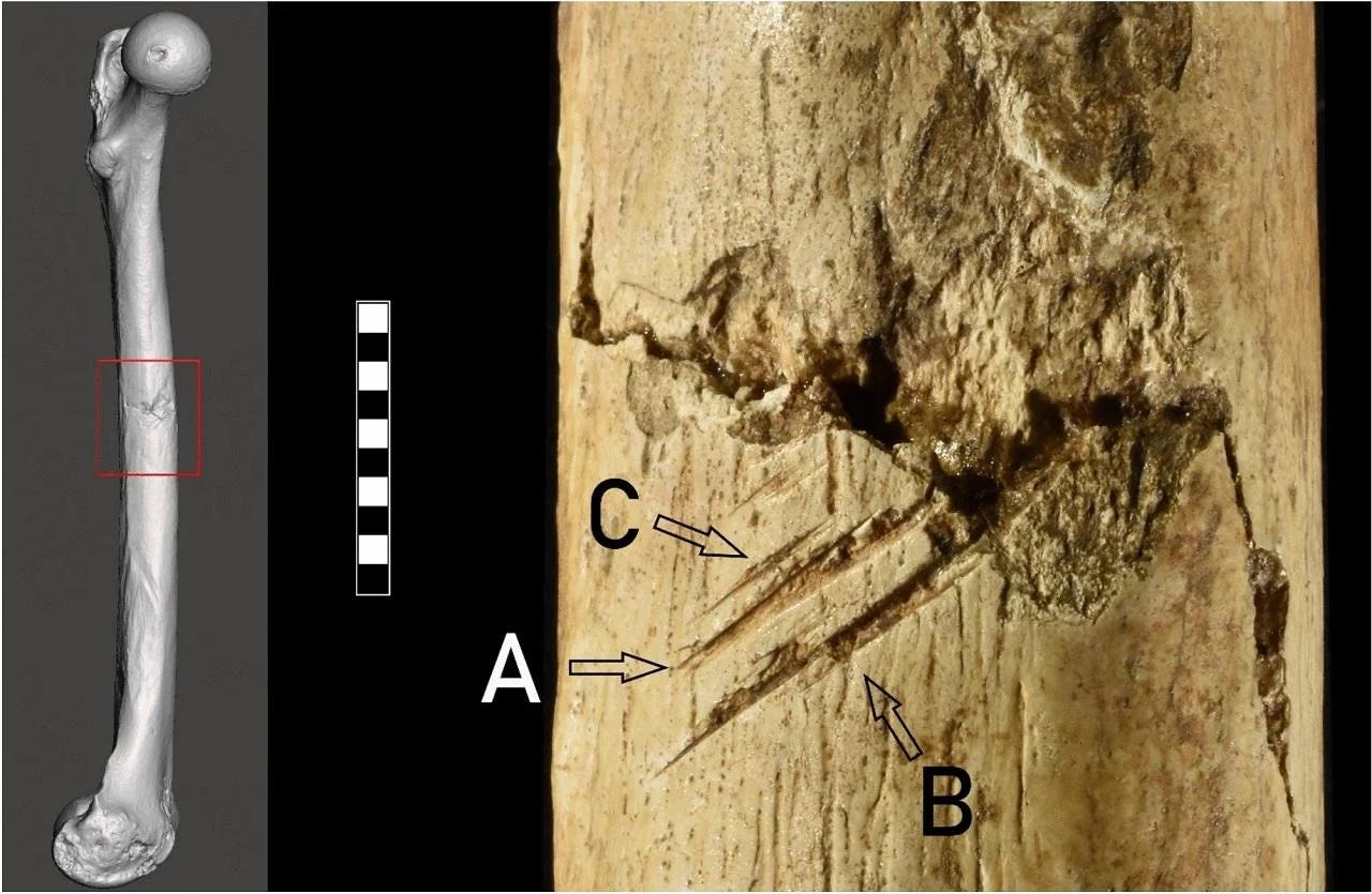 What a 17,000-Year-Old Skeleton Tells Us About Ice Age Conflict episode artwork