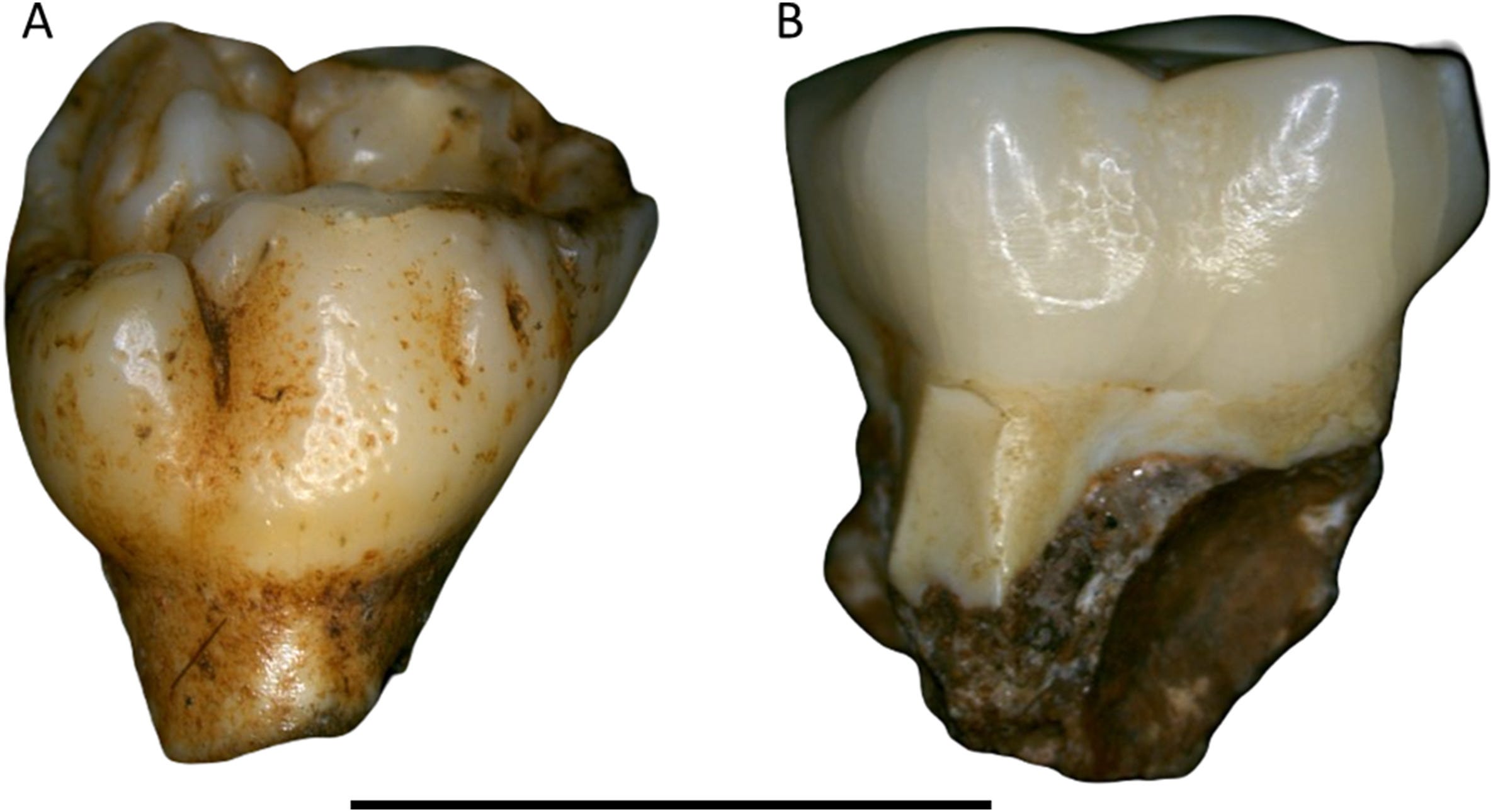 What Tiny Tooth Defects Say About Hominin Evolution episode artwork