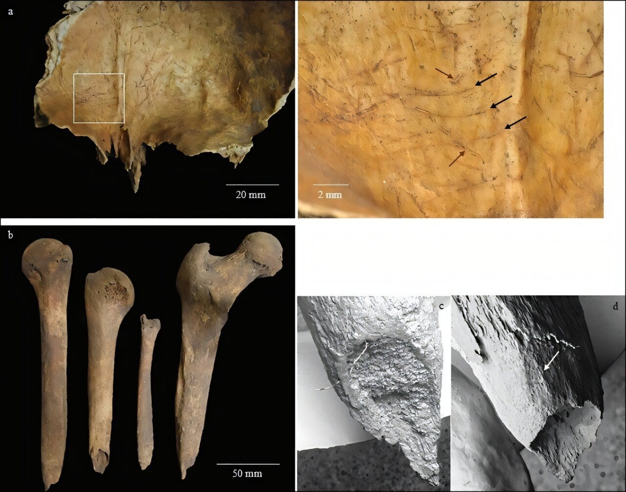 Bone Tools and Borrowed Bodies: The Strange Burial at Loch Borralie episode artwork