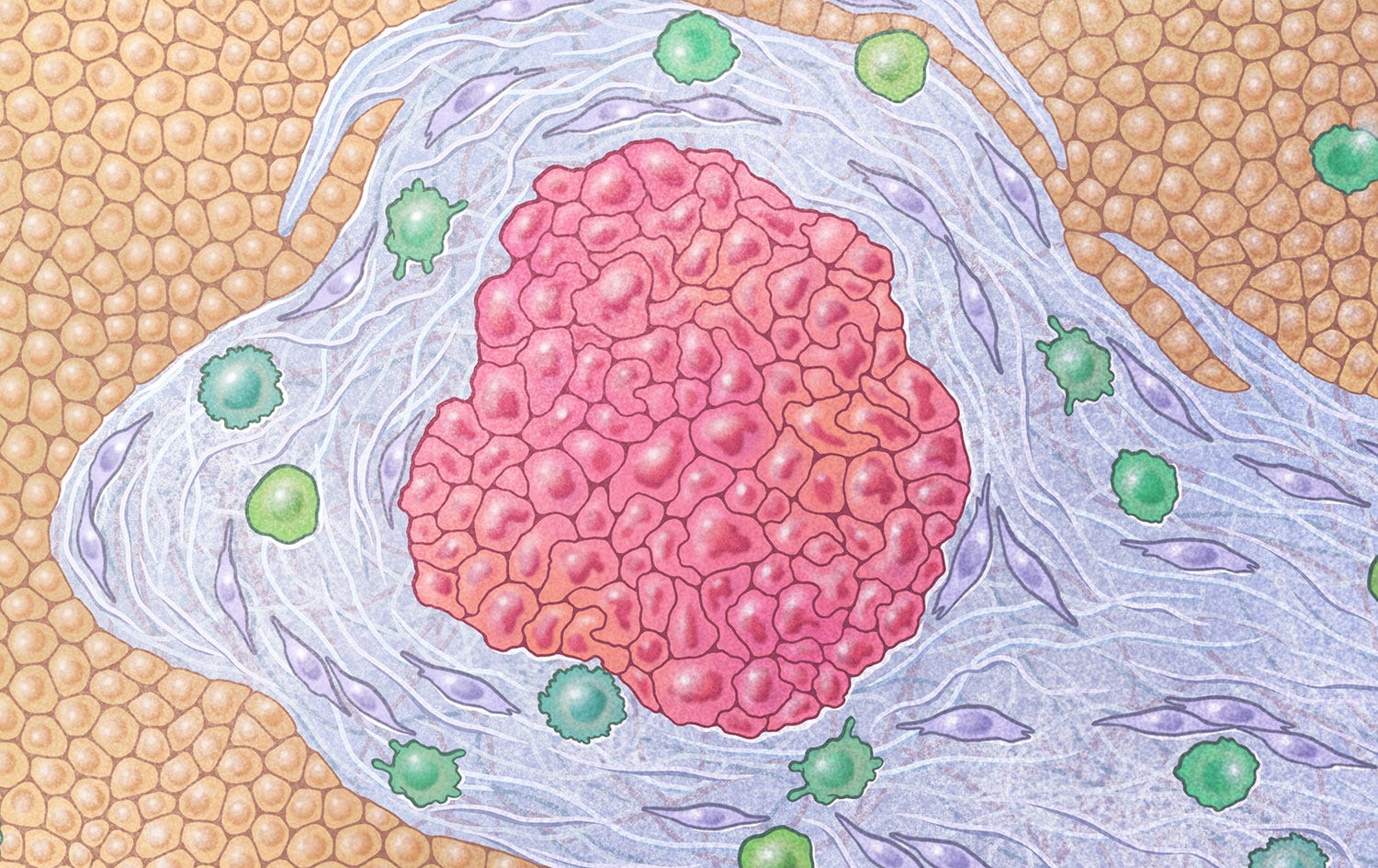 Aaron Newman: A Breakthrough Blood Test for Cancer episode artwork