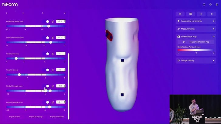 Embedding data and clinical decision-making within the digital prosthetic socket fitting process