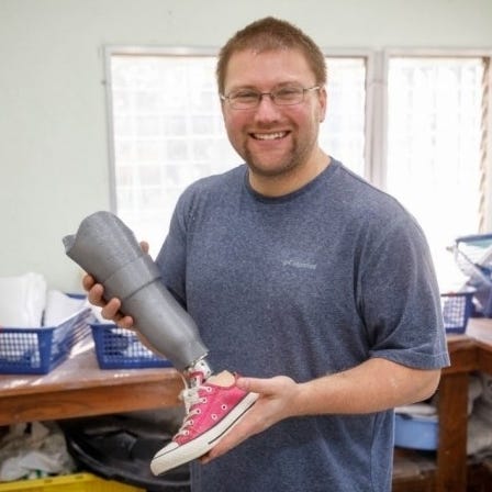 A Journey to Digital Prosthetics