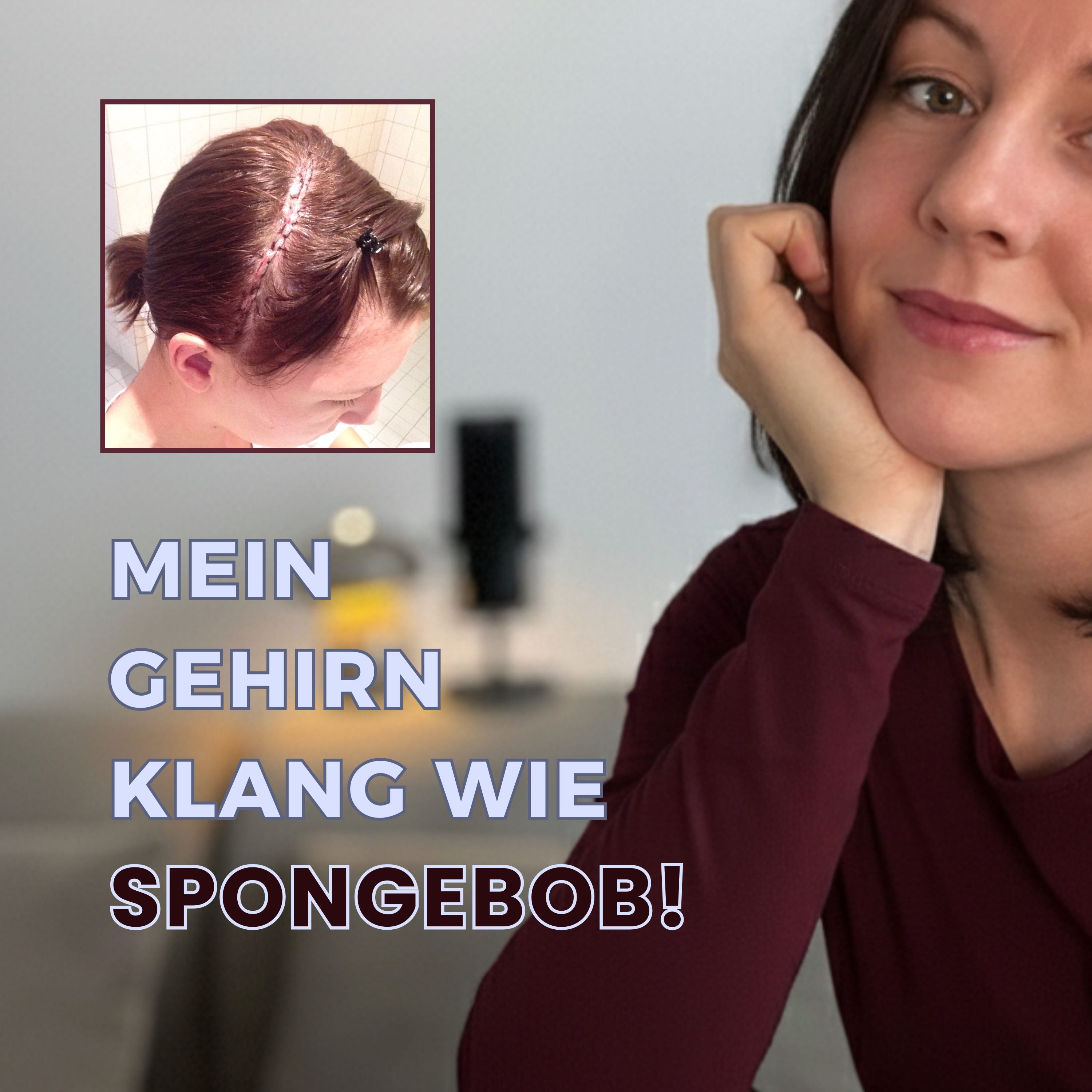 #2 Gehirn-OP mit 22. Was sie mir gab und was SpongeBobs Ananas damit zutun hat. episode artwork