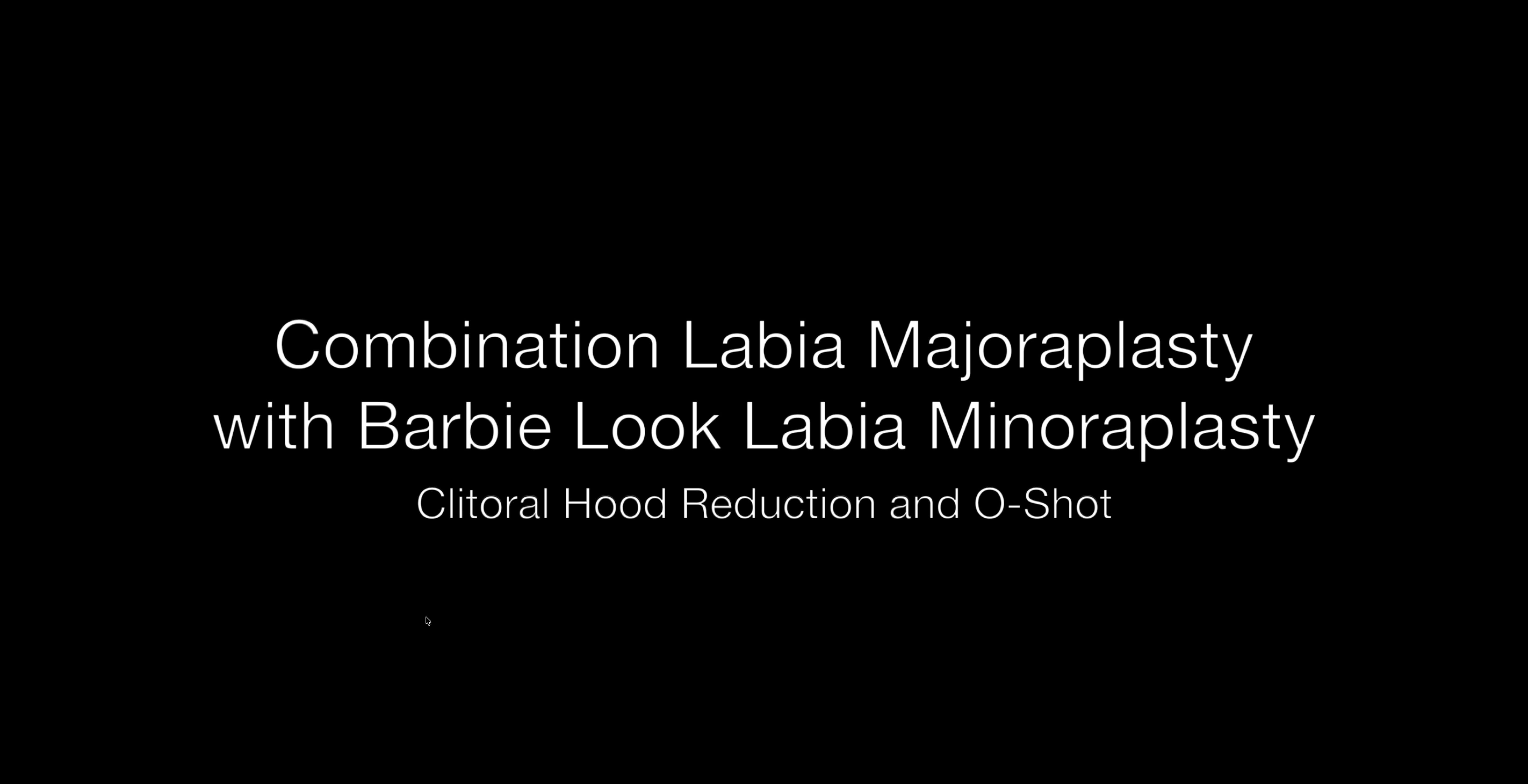 #237: Combination Minora and Majoraplasty with Clitoral Hood Reduction  episode artwork