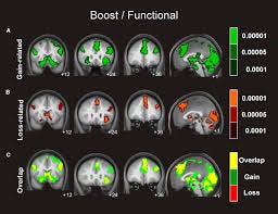 Frontiers | Functional connectivity of reward processing in the brain