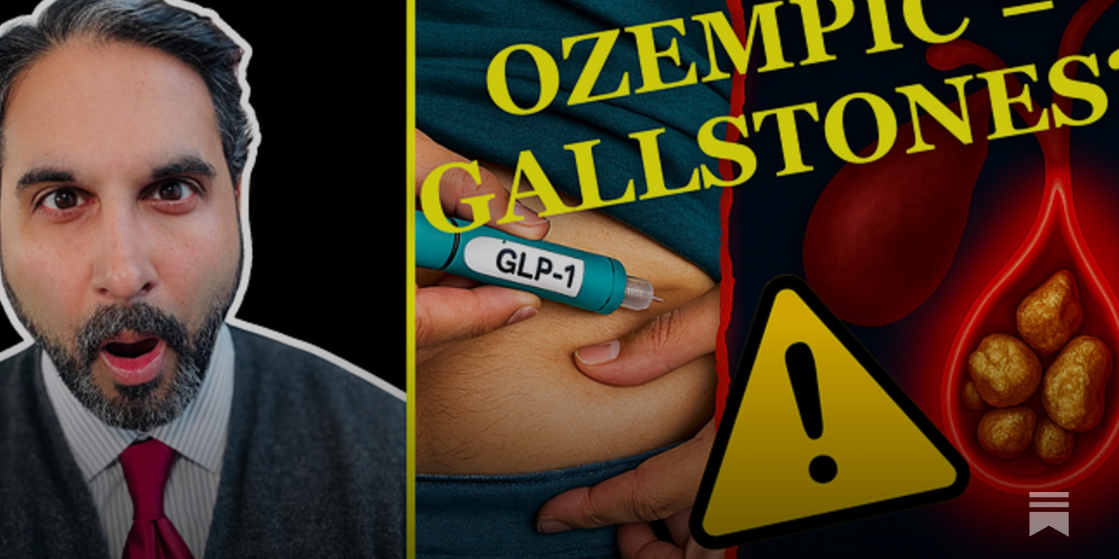 glp 1 gallstones GLP-1 DANGER: The Gallstone Risk No One Told You