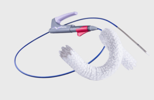 This is a Merit Medical Systems image of its Wrapsody cell-impermeable endoprosthesis.