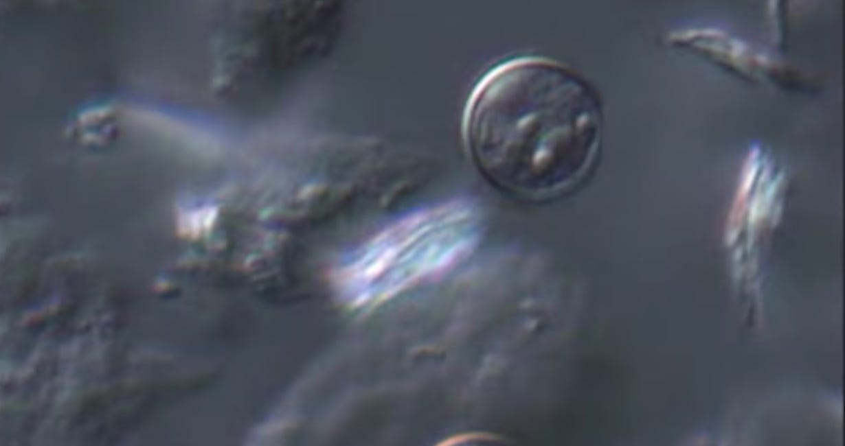 Cyclospora Cases Rise to 16 in Manatee, Sarasota Counties