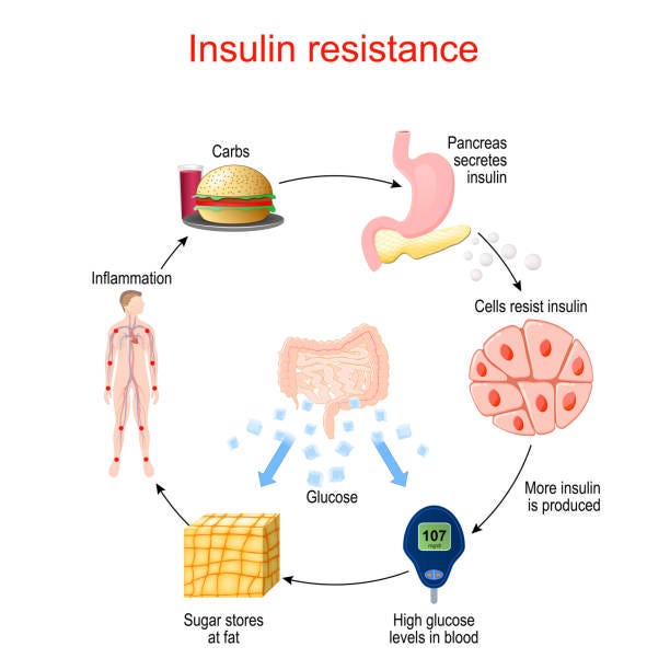 88 Insulin Resistance Illustrations & Clip Art - iStock
