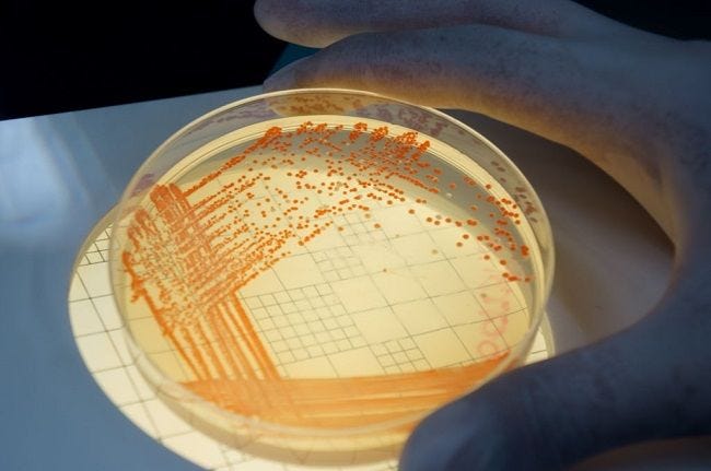 Serratia marcescens