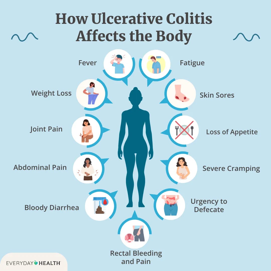 Illustrative graphic titled How Ulcerative Colitis Affects the Body shows Cramping, Bloody Diarrhea, Abdominal Pain, Fever, Rectal Bleeding and Pain, Loss of Appetite, Weight Loss, Urgency to Defecate, Fatigue, Joint Pain, Skin Sores. Everyday Health logo