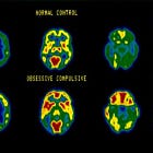 Understanding obsessive-compulsive disorder (OCD) (the basics).