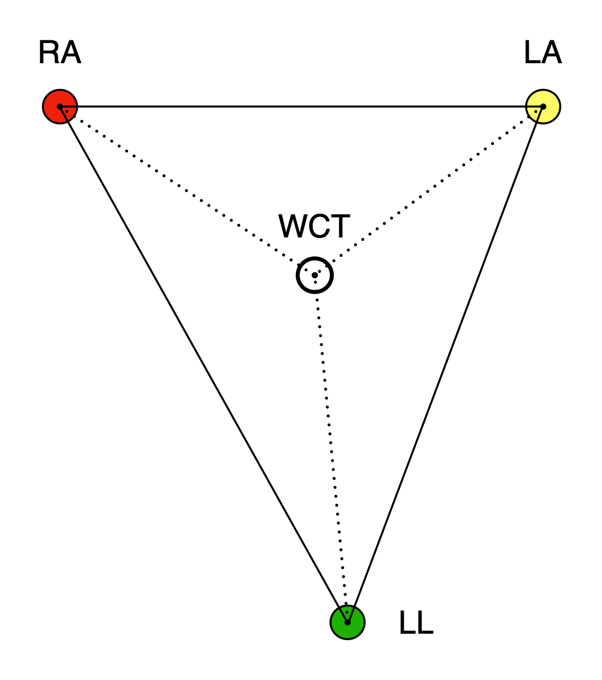 Einthoven's triangle with RA (red), LA (yellow), and LL (green) at the vertices, connected by solid black lines. A small hollow circle in the centre of the triangle is labelled WCT. Three dashed lines connect each vertex to the central WCT circle, indicating that the WCT is the average of the three limb-electrode potentials, not a physical electrode.