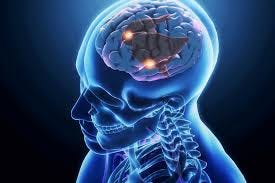 Central Nervous System Disorders ... Central Nervous System Disorders ...