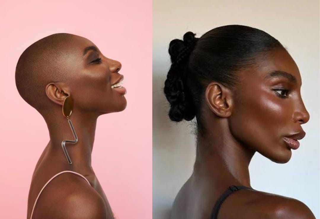 michaela coel, before and after cosmetic surgery. Before photo shows her profile to the side, laughing. After photo is also a profile, with harsh alien-like jawline michaela coel, before and after cosmetic surgery. Before photo shows her profile to the side, laughing. After photo is also a profile, with harsh alien-like jawline