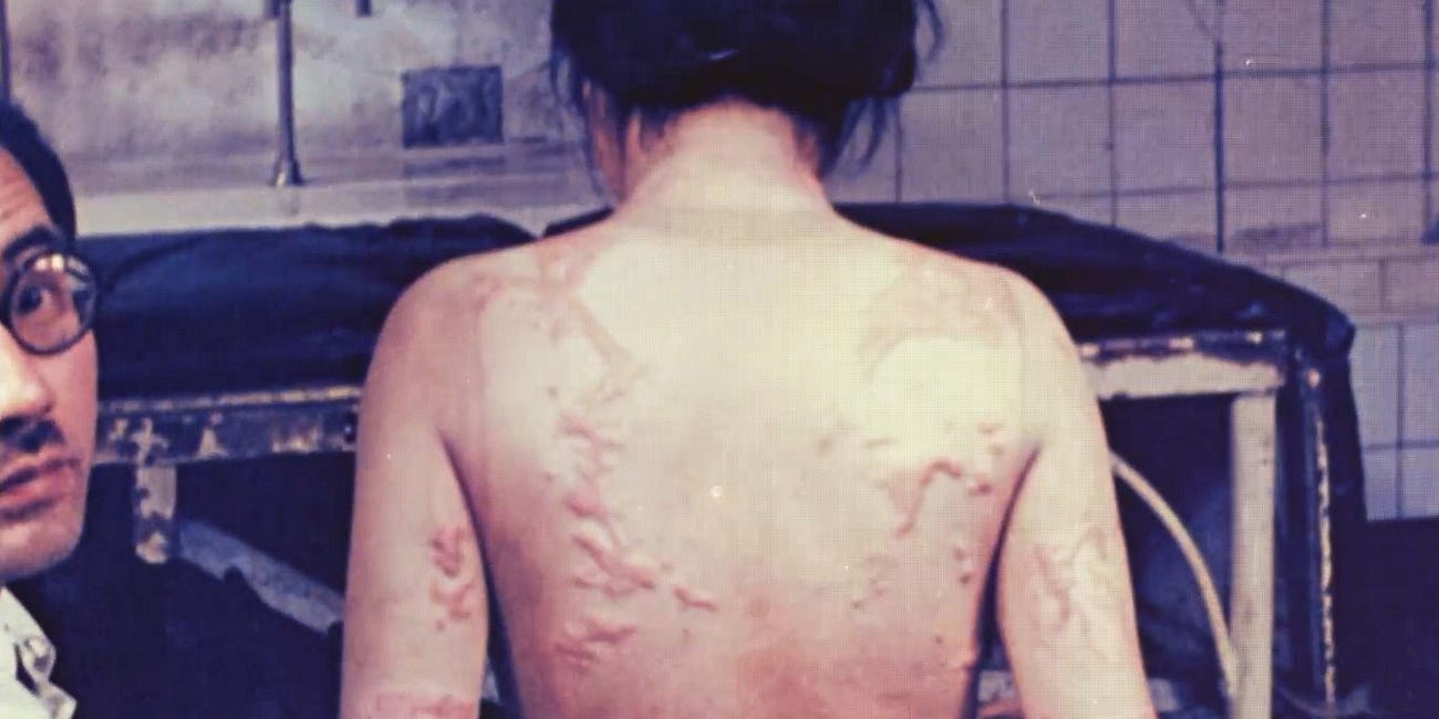 The scarred women of Hiroshima