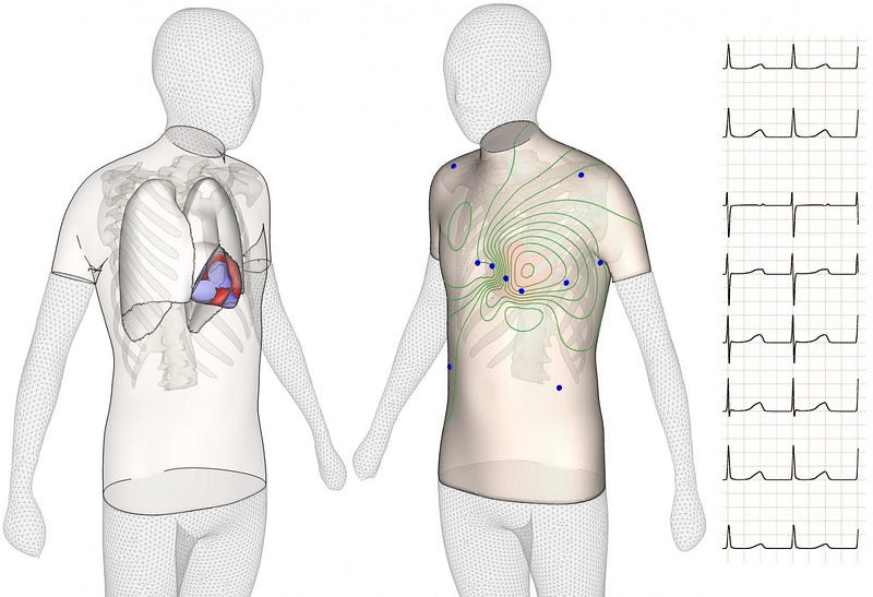 Gemelos digitales del corazón humano