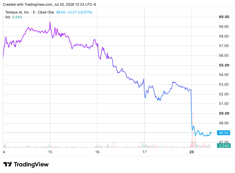 TradingView chart TradingView chart