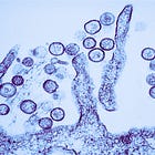 Hantavirus PCR Test Sequences Repeatedly Match Human DNA: New BLAST Analysis Raises False Positive Concerns