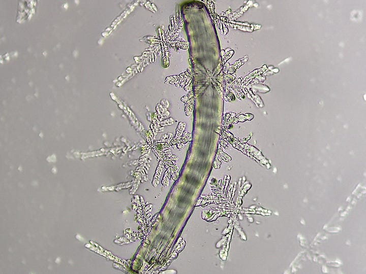 'Things' in urine sample.