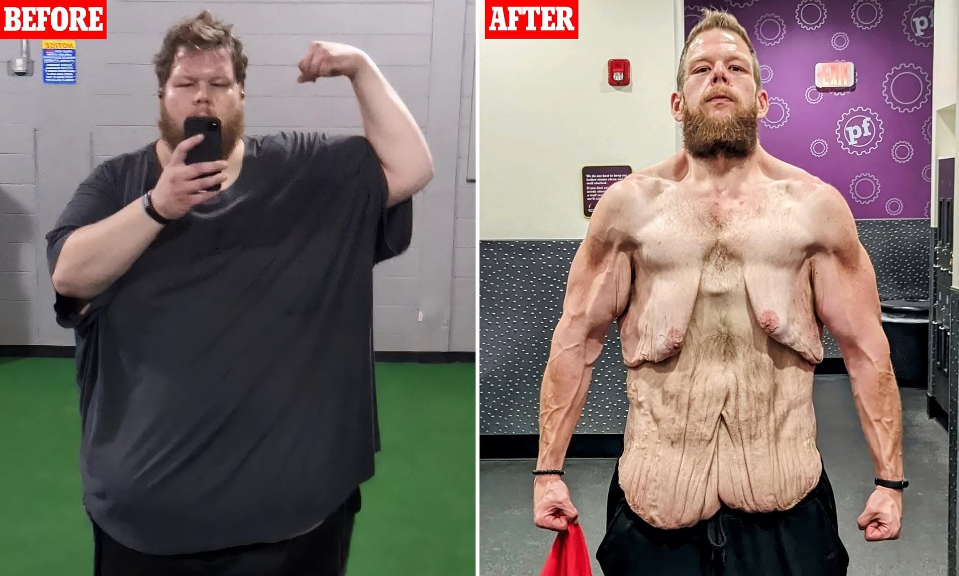 South Carolina man's 300lbs weight-loss pictures set social media alight |  Daily Mail Online