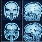 Many "vegetative" patients are conscious and responsive