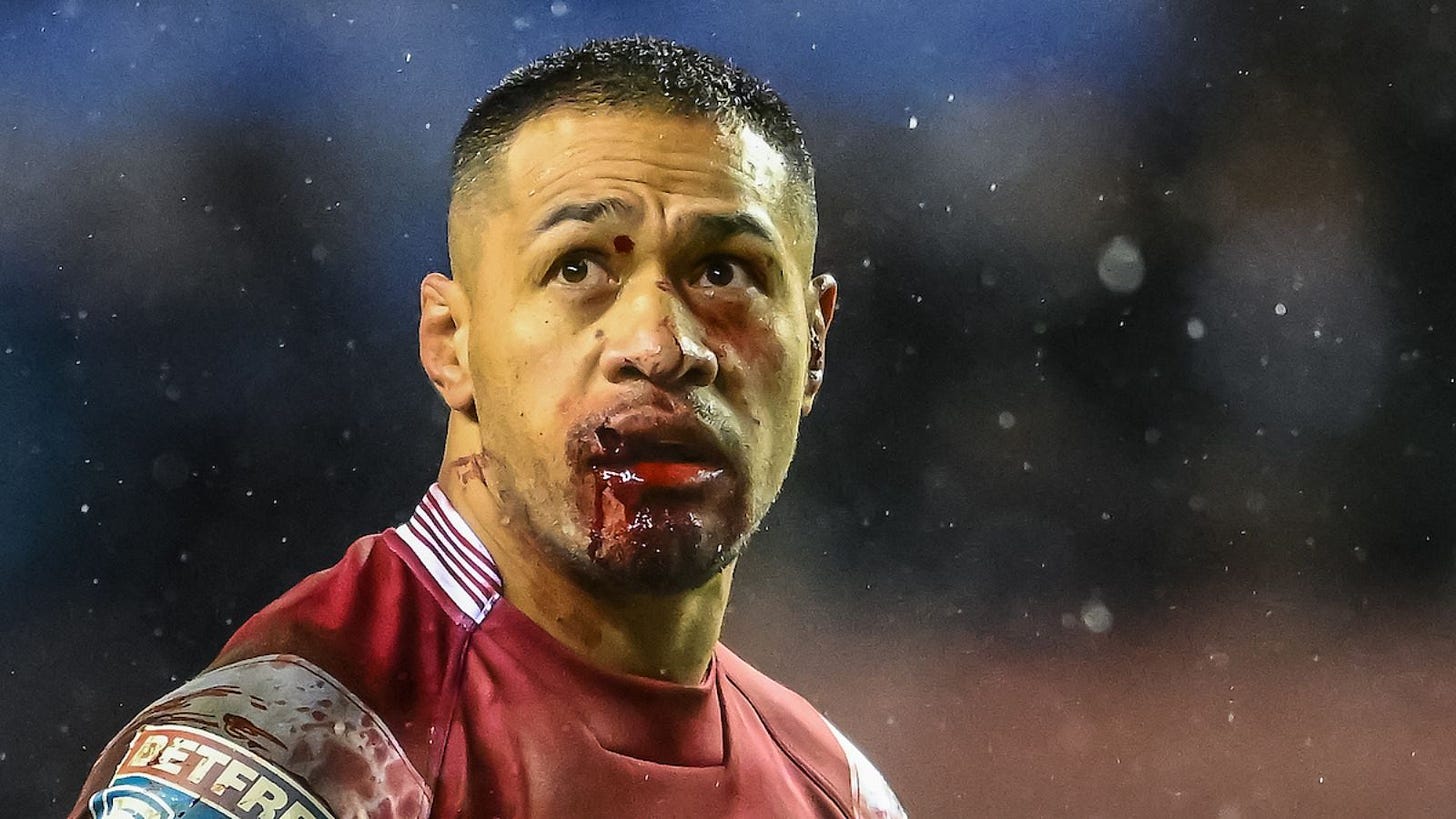 Willie Isa cleared to face Huddersfield following gruesome lip injury