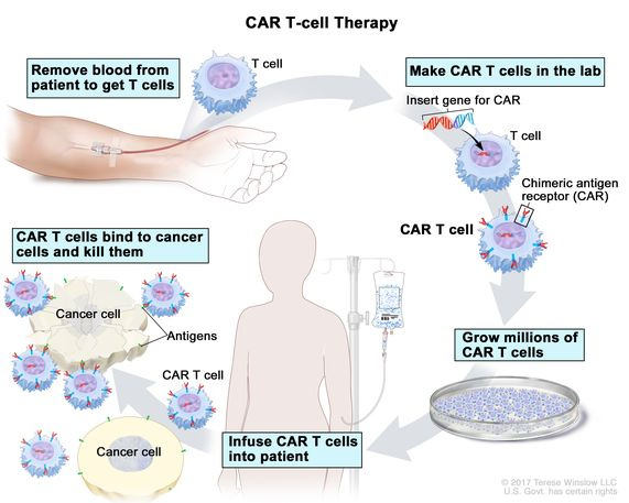 Definition of CAR T-cell therapy - NCI Dictionary of Cancer Terms - NCI