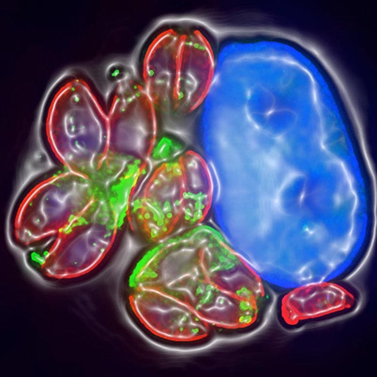 Toxoplasma-Infected Human Cell