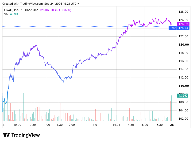TradingView chart TradingView chart