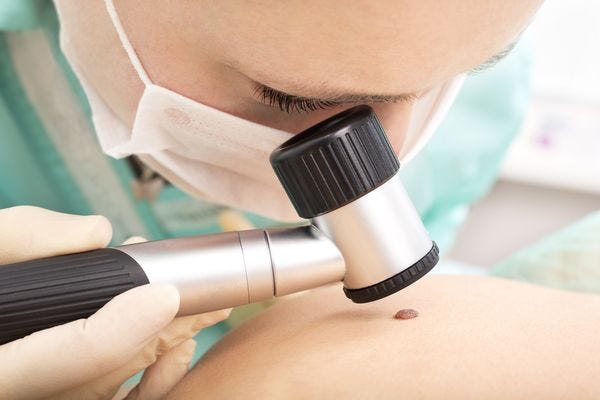 Sito dedicato alla cheratosi attinica -Farmacianews.it