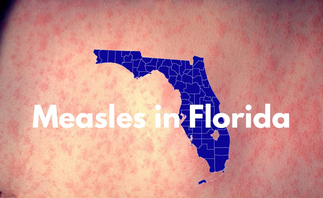 Florida Measles Cases Rise: 92 Confirmed, Outbreak at Ave Maria University