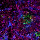 250 Studies Confirm Spike Protein Pathogenicity, Raising Concerns About COVID-19 mRNA Jabs