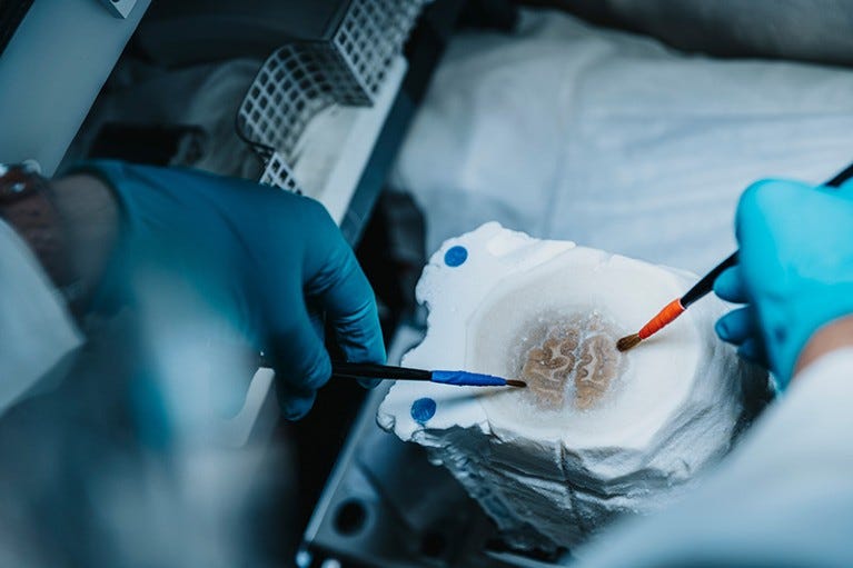 Preparation of a human donor brain at -50 °C prior to Polarized Light Imaging in a lab setting. Preparation of a human donor brain at -50 °C prior to Polarized Light Imaging in a lab setting.