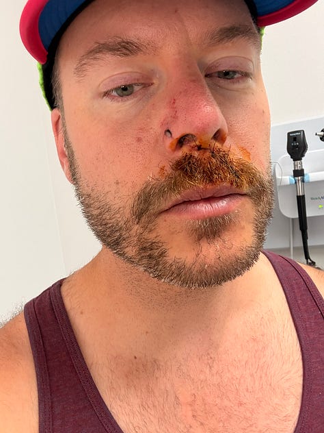 my face moments after being stitches up and my writing for today.