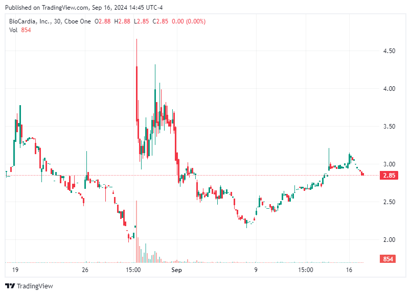 TradingView chart TradingView chart